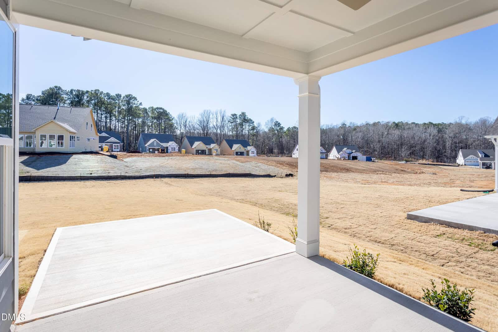 View from a covered patio showing a grassy backyard, newly built homes in the distance, and a tree line under a clear blue sky.